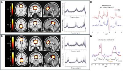 Decreased GABA levels of the anterior and posterior cingulate cortex are associated with executive dysfunction in mild cognitive impairment